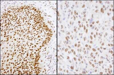 Immunohistochemistry: Matrin 3 Antibody [NB100-1559]