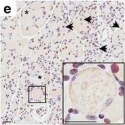 Immunohistochemistry: Matrin 3 Antibody [NB100-1761]
