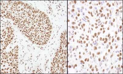 Immunohistochemistry-Paraffin: Matrin 3 Antibody [NB100-1761]