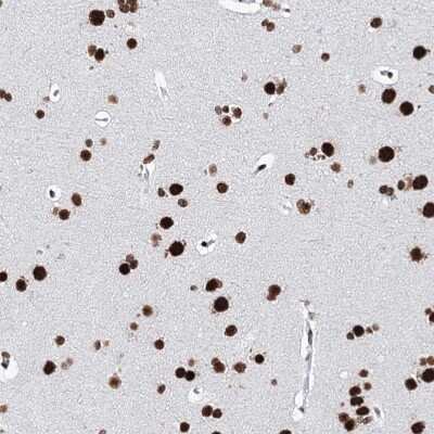 Immunohistochemistry-Paraffin: Matrin 3 Antibody [NBP1-87859]