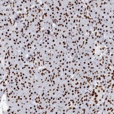 Immunohistochemistry-Paraffin: Matrin 3 Antibody [NBP1-87859]