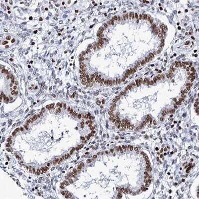 Immunohistochemistry-Paraffin: Matrin 3 Antibody [NBP1-87859]