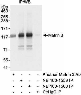 Immunoprecipitation: Matrin 3 Antibody [NB100-1559]