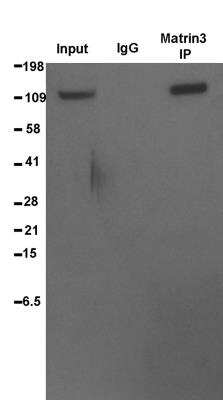 Immunoprecipitation: Matrin 3 Antibody [NB100-1761]