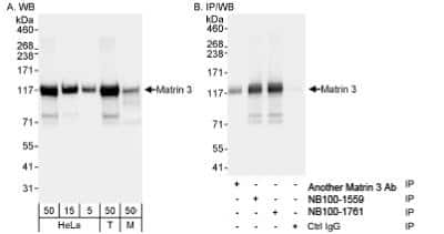 Immunoprecipitation: Matrin 3 Antibody [NB100-1761]