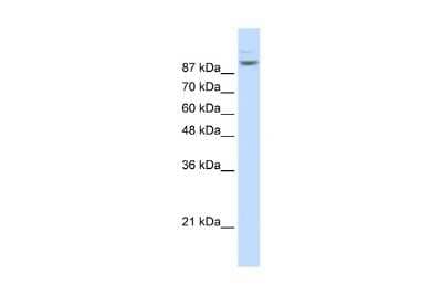 Western Blot: Matrin 3 Antibody [NBP1-57359]