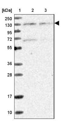 Western Blot: Matrin 3 Antibody [NBP1-87860]