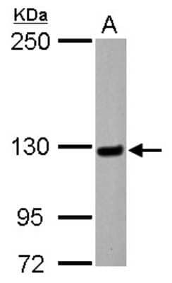 Western Blot: Matrin 3 Antibody [NBP2-17232]