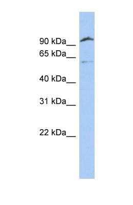 Western Blot: Matriptase 2 Antibody [NBP1-57098]