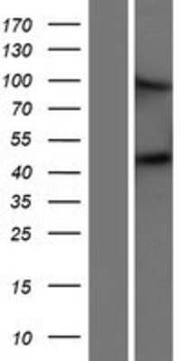 Western Blot: Matriptase 2 Overexpression Lysate [NBP2-05248]