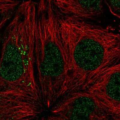 Immunocytochemistry/ Immunofluorescence: Matriptase/ST14 Antibody [NBP3-05520]