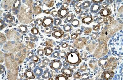 Immunohistochemistry-Paraffin: Matriptase/ST14 Antibody [NBP1-56649]