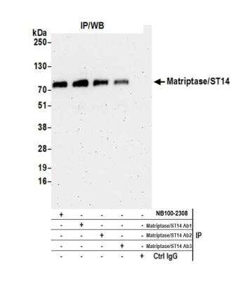 Immunoprecipitation: Matriptase/ST14 Antibody [NB100-2308]