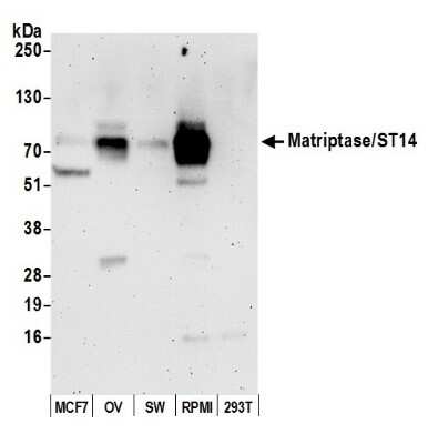 Western Blot: Matriptase/ST14 Antibody [NB100-2308]