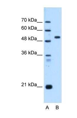 Western Blot: Matriptase/ST14 Antibody [NBP1-56649]