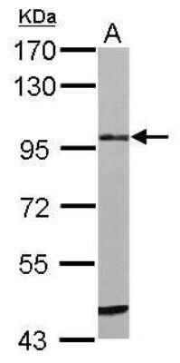 Western Blot: Matriptase/ST14 Antibody [NBP2-42884]