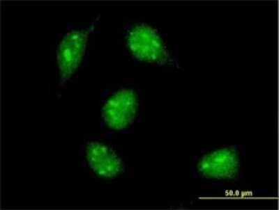 Immunocytochemistry/ Immunofluorescence: Max Antibody (4E10-1A9) [H00004149-M01]