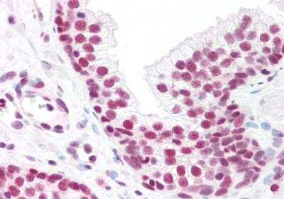 Immunohistochemistry-Paraffin: Max Antibody [NB100-793]