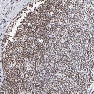 Immunohistochemistry-Paraffin: Max Antibody [NBP1-88624]