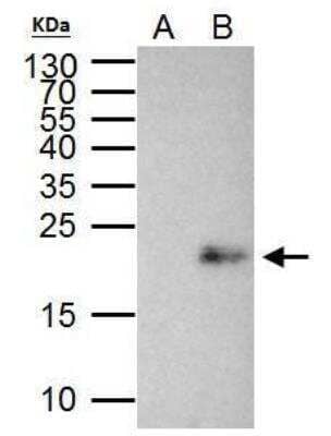 Immunoprecipitation: Max Antibody [NBP2-17233]