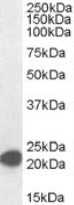 Western Blot: Max Antibody [NB100-793]