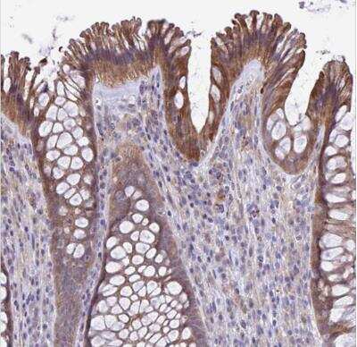 Immunohistochemistry-Paraffin: Maxi Potassium channel alpha Antibody [NBP2-33726]