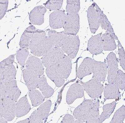 Immunohistochemistry-Paraffin: Maxi Potassium channel alpha Antibody [NBP2-33726]