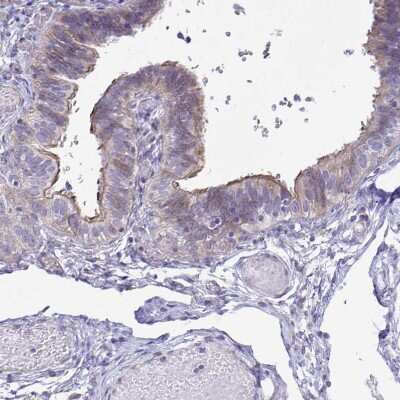 Immunohistochemistry-Paraffin: Maxi Potassium channel alpha Antibody [NBP2-33726]