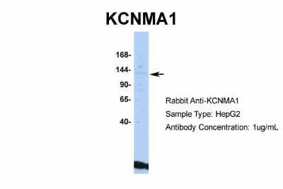 Western Blot: Maxi Potassium channel alpha Antibody [NBP2-87781]