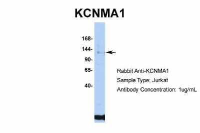 Western Blot: Maxi Potassium channel alpha Antibody [NBP2-87781]
