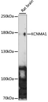 Western Blot: Maxi Potassium channel alpha AntibodyAzide and BSA Free [NBP3-03012]