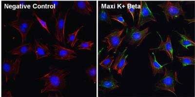 Immunocytochemistry/ Immunofluorescence: Maxi Potassium channel beta Antibody [NB300-535]