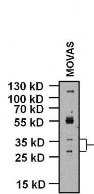 Western Blot: Maxi Potassium channel beta Antibody [NB300-535]