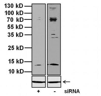 Western Blot: Maxi Potassium channel beta Antibody [NB300-535]