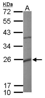 Western Blot: Maxi Potassium channel beta Antibody [NBP1-33484]