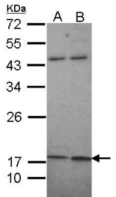 Western Blot: Maxi Potassium channel beta Antibody [NBP1-33484]