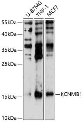 Western Blot: Maxi Potassium channel beta AntibodyBSA Free [NBP3-03655]