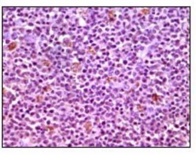 Immunohistochemistry-Paraffin: Mcl-1 Antibody (8C6) - BSA Free [NB100-2194]