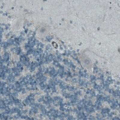Immunohistochemistry-Paraffin: Mcl-1 Antibody (CL1128) [NBP2-52968]