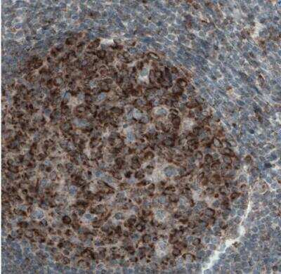 Immunohistochemistry-Paraffin: Mcl-1 Antibody (CL1128) [NBP2-52968]