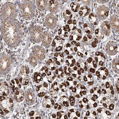 Immunohistochemistry-Paraffin: Mcl-1 Antibody [NBP1-90006]