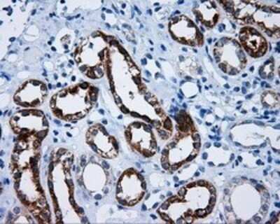 Immunohistochemistry: Mcl-1 Antibody (OTI10F6) [NBP2-45773]
