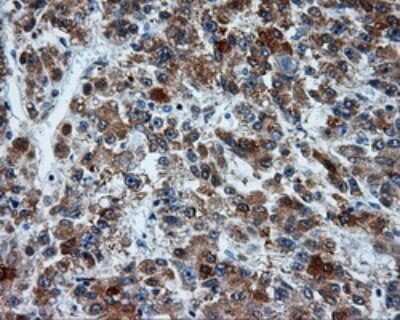 Immunohistochemistry: Mcl-1 Antibody (OTI10F6) [NBP2-45773]