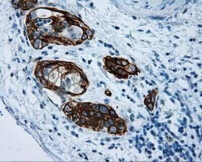 Immunohistochemistry: Mcl-1 Antibody (OTI10F6) [NBP2-45773]