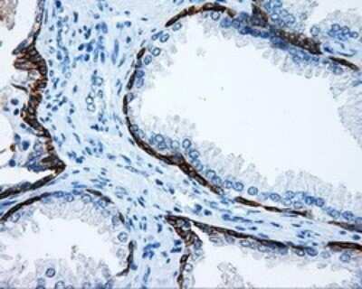 Immunohistochemistry: Mcl-1 Antibody (OTI10F6) [NBP2-45773]