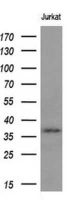 Western Blot: Mcl-1 Antibody (OTI10F6) [NBP2-45773]