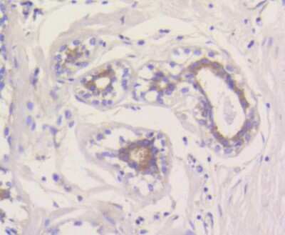 Immunohistochemistry-Paraffin: Mcl-1 Antibody (SI16-04) [NBP2-67400]