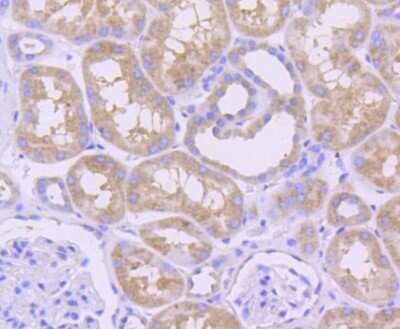 Immunohistochemistry-Paraffin: Mcl-1 Antibody (SI16-04) [NBP2-67400]