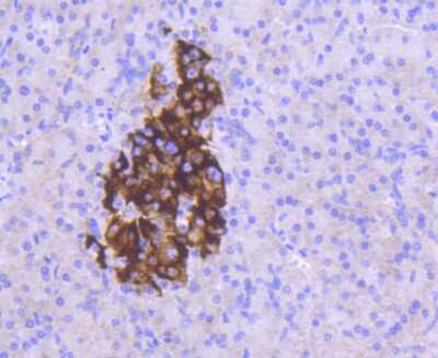 Immunohistochemistry-Paraffin: Mcl-1 Antibody (SI16-04) [NBP2-67400]