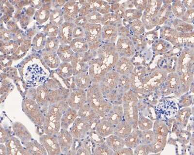 Immunohistochemistry-Paraffin: Mcl-1 Antibody (SI16-04) [NBP2-67400]